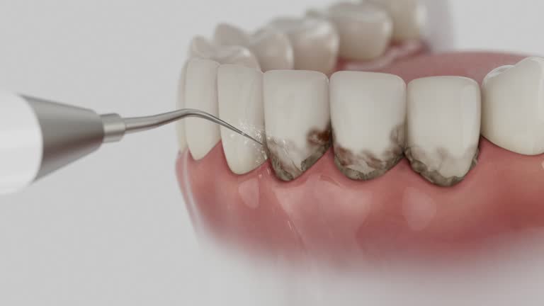 Trusted Teeth Cleaning And Checkup service in St. George, MO - Dentist Open Now